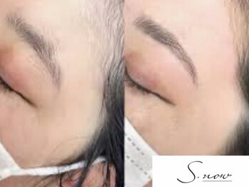 スノー(S.now)の写真/【マリムーブフェイシャルワックス正規認定サロン】美肌の土台作りにはフェイシャルワックス♪
