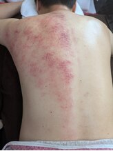 リデザイン 京都(REDESIGN)/REDESIGN京都中医施術法