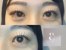 グランウィーユ バイ ロンド 銀座(Grand oeil by Lond)/【mizuki】アンドヘルシー100本