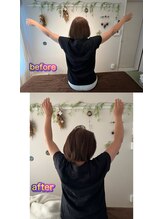 晴(HARE)/五十肩で上がらない腕もp(^_^)q