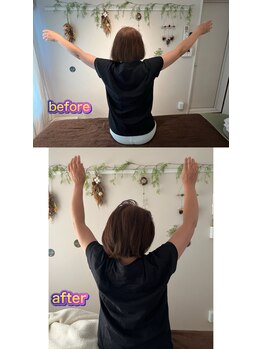 晴(HARE)/五十肩で上がらない腕もp(^_^)q