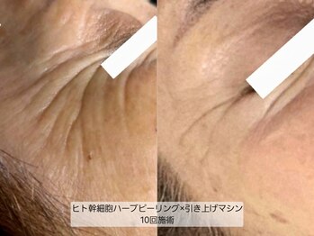 サロンドリー(salon de Re)/