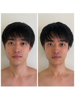 小顔矯正専門店Courage(クラージュ)天王寺店　【10/1 OPEN（予定）】の写真/気になるほうれい線・たるみに徹底アプローチ！エイジングケアも叶う小顔サロン