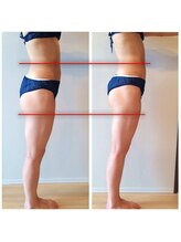 骨盤ストレッチ整体 b/骨盤矯正★変化写真