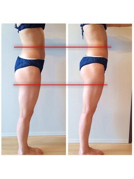 骨盤ストレッチ整体 b/骨盤矯正★変化写真