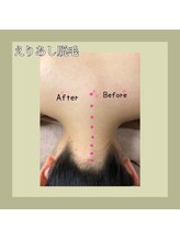 レイビス 盛岡店(RAYVIS)/えりあしの脱毛☆