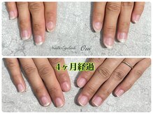 ウイ(Oui)/自爪育成