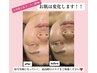 【50%高濃度幹細胞エステ】老化対策！たるみ・くすみ・シワ予防コース！