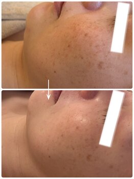 スリムアンドビューティー メゾン ド シュシュ(Slim&Beauty Maison de chouchou)/韓国肌育ララピール