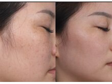 ユミサロン(U Mi Salon)/