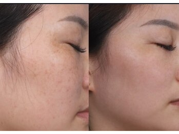 ユミサロン(U Mi Salon)/