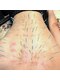 とだ鍼灸院の写真/《八丁堀》理学療法士の資格保有の院長がマンツーマン施術!!初めて鍼を受ける方も安心して通える鍼灸院*