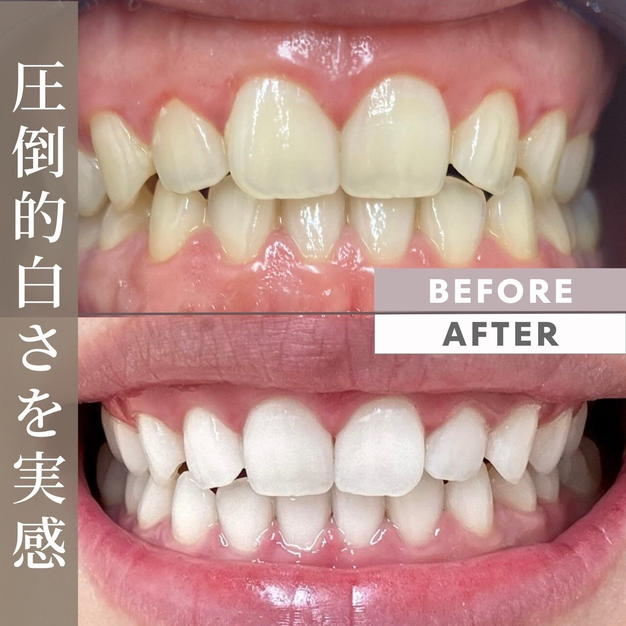 ホワイトニングショップ 徳島藍住店｜ホットペッパービューティー