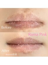 リラ(Lyra)/ローマピンク