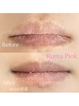 リラ(Lyra)/ローマピンク