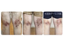 マーレ(Mare)/足湯で巡りケア