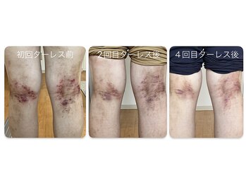 マーレ(Mare)/足湯で巡りケア