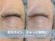 ラシック 加古川店(La chic.)の写真/お顔全体のたるみ・もたつきを徹底ケア!レッドショットとEMSで、自信が持てる上向きの引き締まった表情へ
