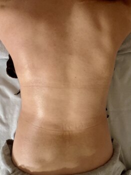 ブルームオーラ 月(BLOOM AURA)/左右で一目瞭然!リンパの効果