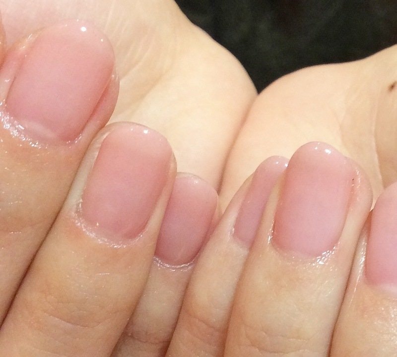 手荒れ 指が短い 手のむくみ 手のお悩み解決法 ホットペッパービューティーマガジン 手荒れ 指が短い 手のむくみ 手のお悩み解決法 ホットペッパービューティーマガジン