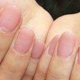 手荒れ、指が短い、手のむくみ…手のお悩み解決法