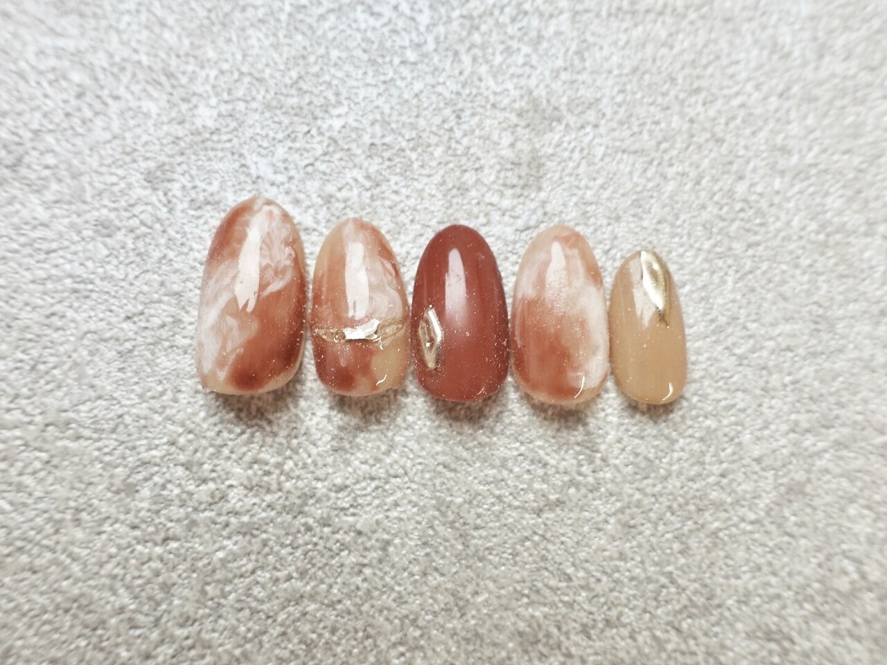 トレンド定額