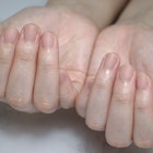 自爪風ネイル